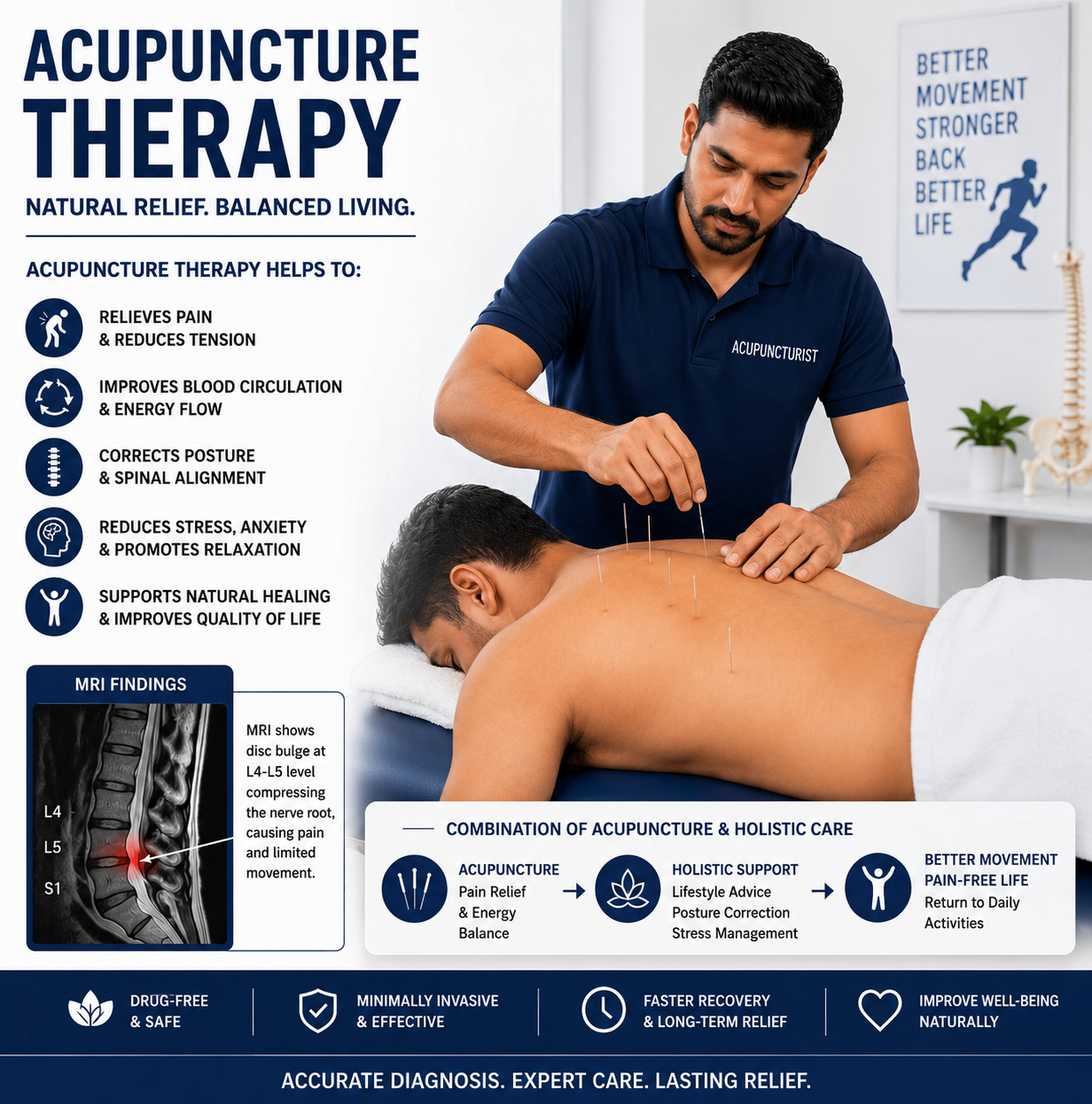 Acupuncture
