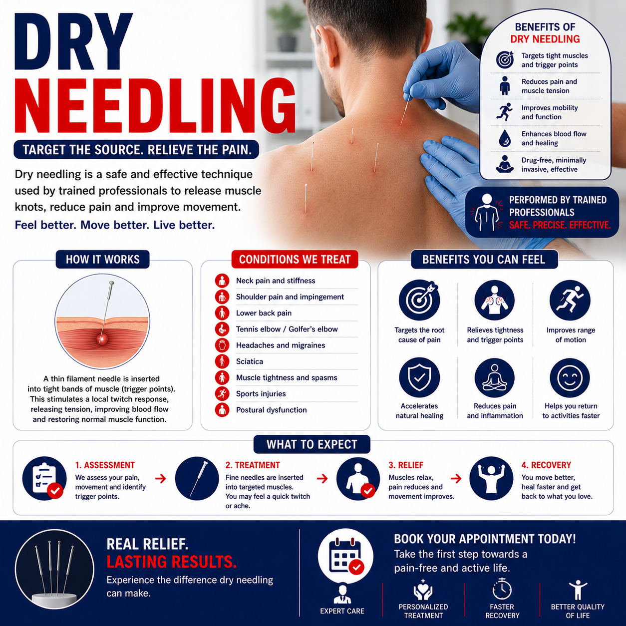 Dry Needling Therapy