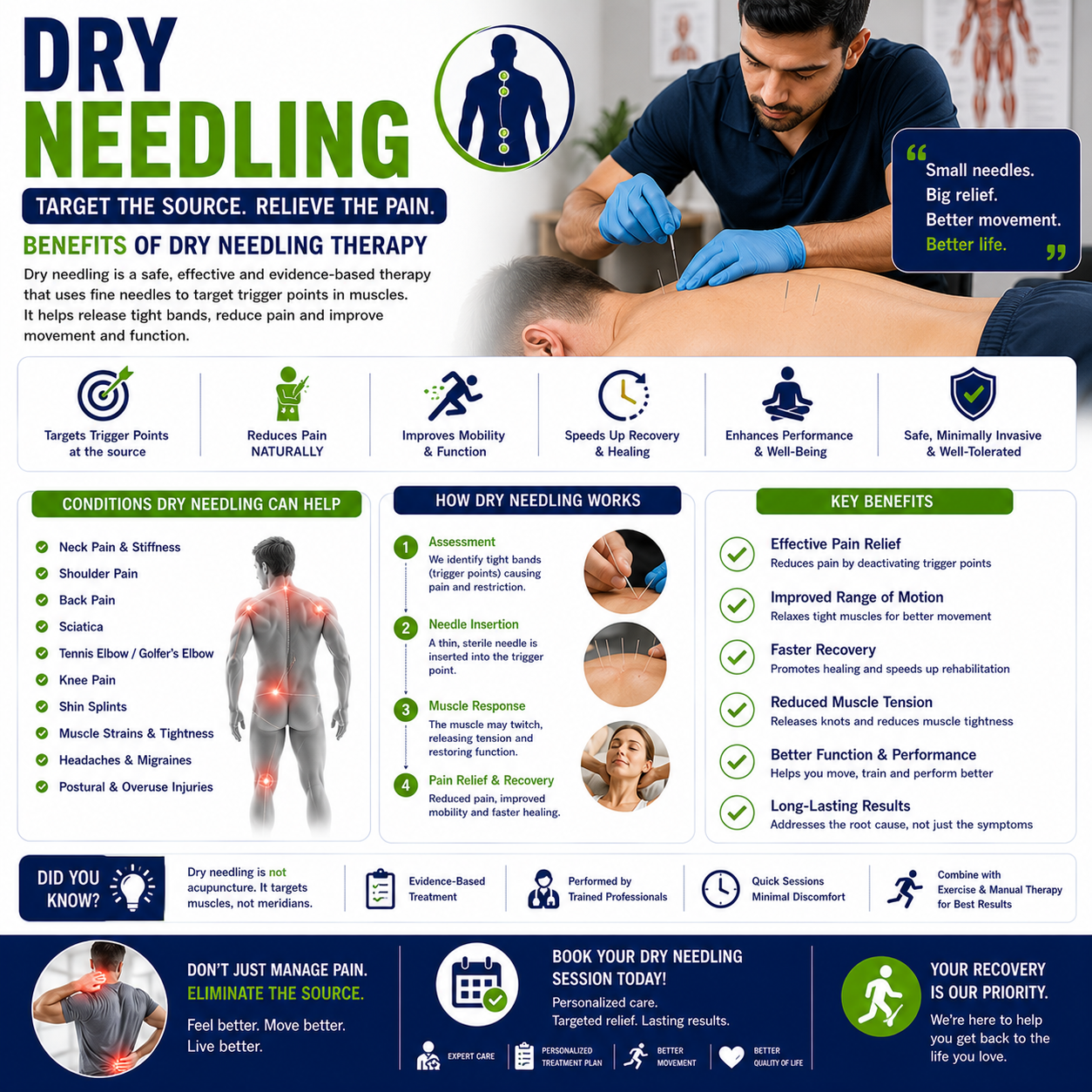 Dry Needling
